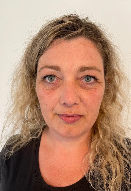 Testperson Kosmetisk akupunktur hos AM Wellness Testperson Kosmetisk akupunktur hos AM Wellness