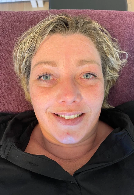 Testperson Kosmetisk akupunktur hos AM Wellness Testperson Kosmetisk akupunktur hos AM Wellness